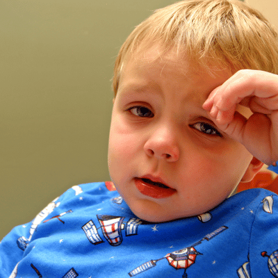 Toddler looking sick and tired.