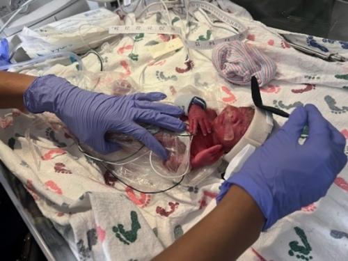 Blessing Johnson first days in the NICU.